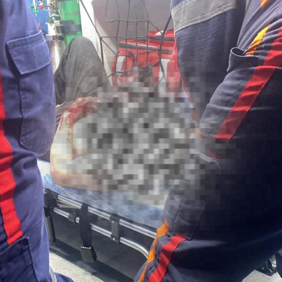 Homem é vítima de tentativa de homicídio em Araucária na madrugada deste domingo, 28